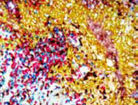 IHC picture of formalin-fixed paraffin-embedded human tonsil