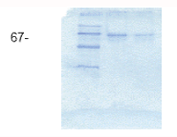 LBP (human), (recombinant) (His-tag) SDS-PAGE