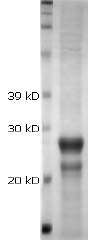 CTRP2 (globular domain) (mouse), (recombinant) SDS-PAGE