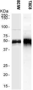 PTX3 polyclonal antibody WB