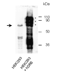 DR6 (human) polyclonal antibody WB transfected