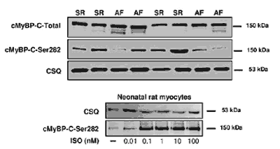 [pSer282]Myosin-binding protein C (cardiac type) polyclonal antibody WB