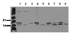LC3B monoclonal antibody (2G6) Western blot