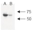 c-IAP1 monoclonal antibody (1E1-1-10) Western blot
