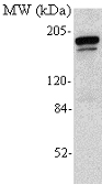 Dnmt1 monoclonal antibody (60B1220.1) Western blot