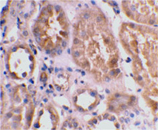 Bnip3L (IN) polyclonal antibody Immunohistochemistry