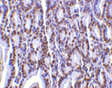 PHAP I (CT) polyclonal antibody Immunohistochemistry