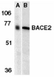 BACE2 (NT) polyclonal antibody Western blot