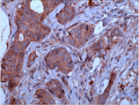 Osteopontin monoclonal antibody (87-B) Immunohistochemistry