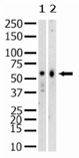 SET07 monoclonal antibody (43AT551.86.76) Western blot