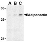Adiponectin polyclonal antibody Western blot