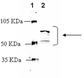 Adrenergic receptor &beta;2 polyclonal antibody Western blot