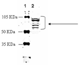 Adrenergic receptor &beta;1 polyclonal antibody Western blot