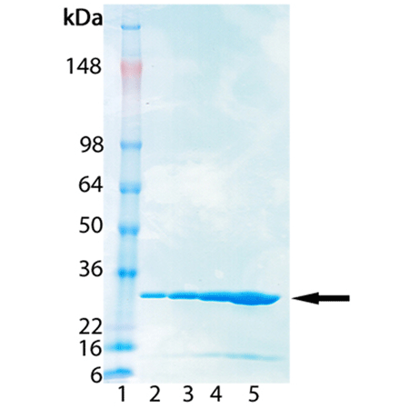 NMNAT3 (human), (recombinant) (His-tag) SDS-PAGE