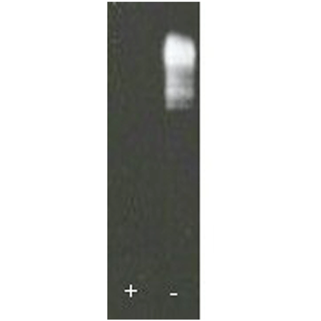 ([K11-only]Ub)n-ubiquitinylated substrate Western blot