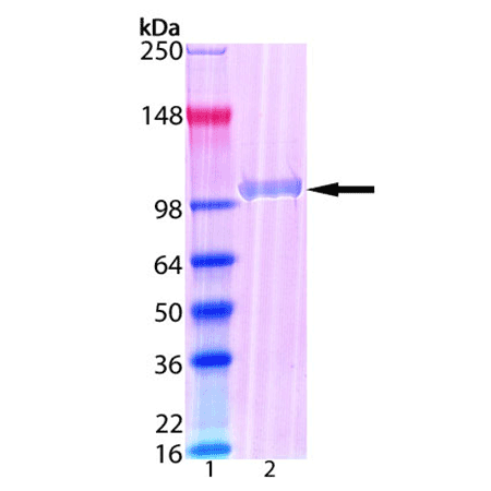 Isopeptidase T (short form) (human), (recombinant) SDS-PAGE