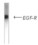 EGF receptor monoclonal antibody (6F1) Western blot