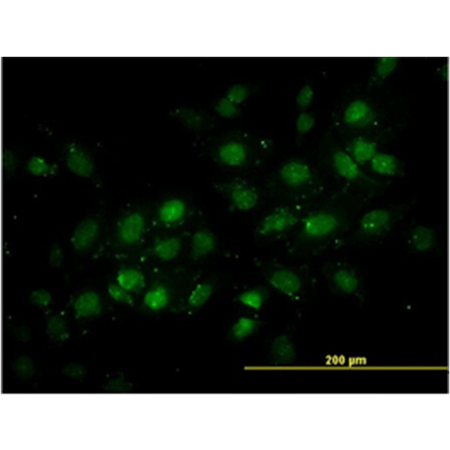 TRDMT1/DNMT2 monoclonal antibody (1E12) Immunofluorescence