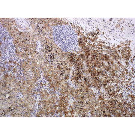 PD-L1 monoclonal antibody IHC lung tissue