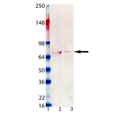 Zap-70 monoclonal antibody (11H40) Western blot