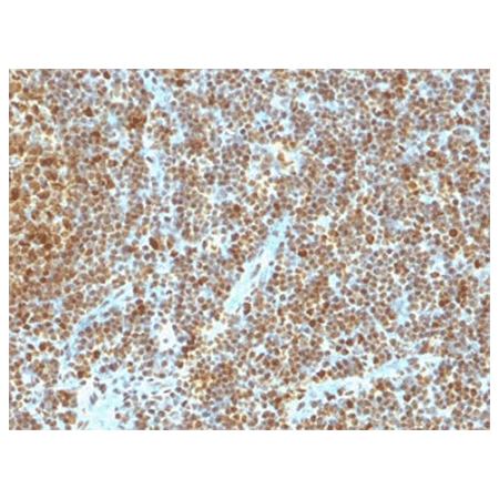 PCNA monoclonal antibody (SPM350) IHC
