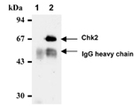 Chk2 monoclonal antibody (DCS-270) Immunoprecipitation