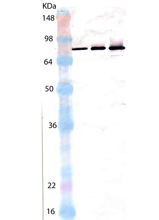 ERp72 (human), (recombinant) (His-tag) Western blot