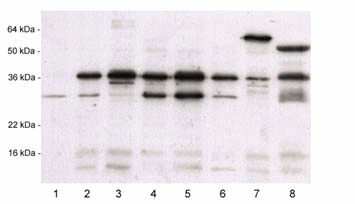 14-3-3&sigma; polyclonal antibody Western blot