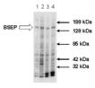 BSEP (human) monoclonal antibody (USal-hBSEP-McAb-1) Western blot