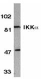 IKK &alpha; polyclonal antibody Western blot