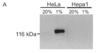 HIF-1&alpha; monoclonal antibody (mgc3) Western blot