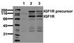 [pTyr1316]IGF-1 receptor monoclonal antibody (2B9) Western blot