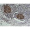 HIGHDEF DAB Chromogen/Substrate Set IHC cancer tonsil tissue 2