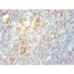 Transglutaminase 2 monoclonal antibody (419) IHC tonsil