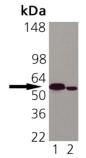 Calreticulin monoclonal antibody (FMC 75) Western blot