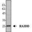 RAIDD (human) polyclonal antibody (AT100) WB