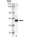 USP14 (human), (recombinant) (untagged) SDS-PAGE