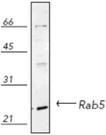 RAB5 polyclonal antibody Western blot
