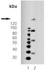 PDGF receptor &beta; monoclonal antibody (42G12) Western blot