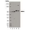 Insulin receptor &beta; monoclonal antibody (C18C4) Western blot