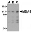 MDA5 polyclonal antibody Western blot