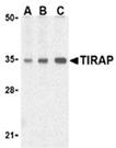 TIRAP polyclonal antibody Western blot