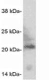 Caveolin-3 polyclonal antibody Western blot