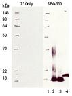 Metallothionein monoclonal antibody (UC1MT) Western blot