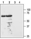 Melanocortin receptor 3 (extracellular) polyclonal antibody Western blot
