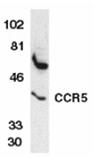 CCR5 (NT) polyclonal antibody Western blot