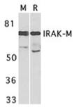 IRAK-M polyclonal antibody Western blot