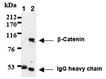 &beta;-Catenin monoclonal antibody (12F7) Immunoprecipitation
