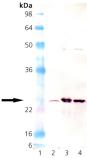 Mn SOD polyclonal antibody Western blot