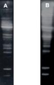 Polyubiquitin (K63-linkage-specific) monoclonal antibody (HWA4C4) Western blot